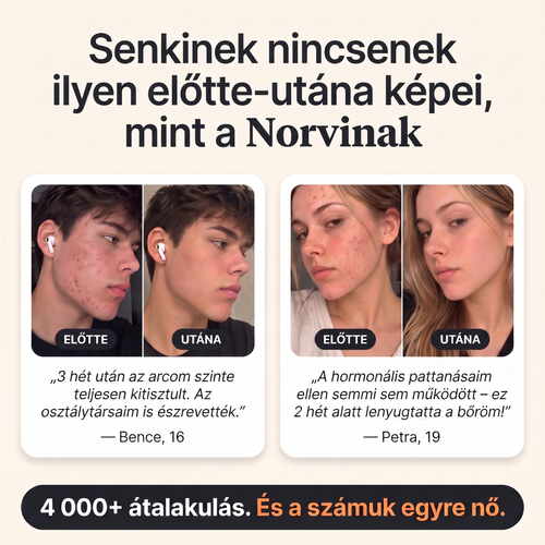 Norvi Pattanás-Stop – 4 000+ átalakulás, előtte-utána